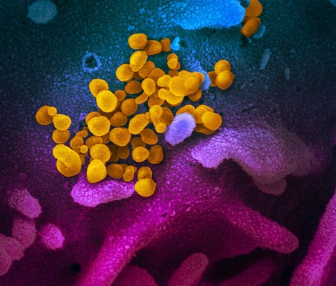 Coronavirus update: India tally crosses 8 million mark