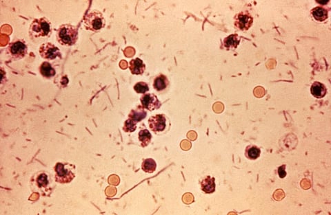 As Shigella spurs panic in Kerala, health dept says nothing to worry   