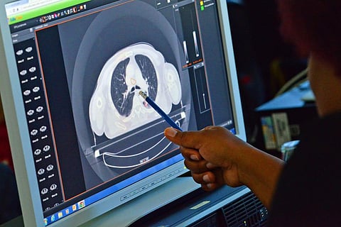 WHO releases technical guidance for procurement, safe use of radiotherapy devices