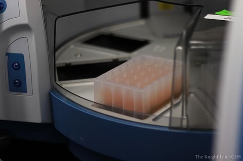 Sewage-testing robots process wastewater faster to predict COVID-19 outbreaks sooner