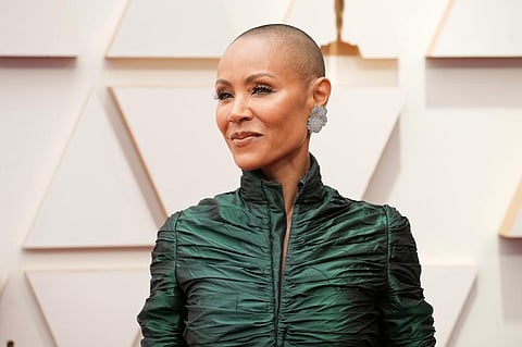 What is alopecia? It’s no laughing matter for millions of Black American women