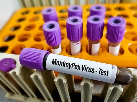 Monkeypox not public health emergency of international concern yet. Do we need to update our understanding of this label?