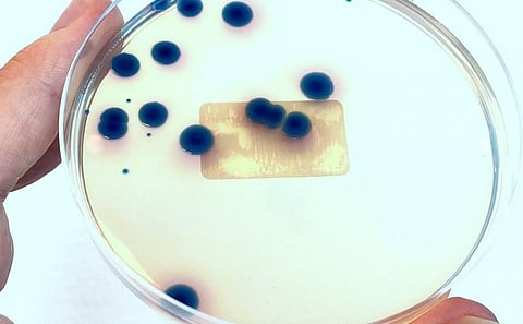 Carbapenem-resistant Klebsiella. Photo: iStock