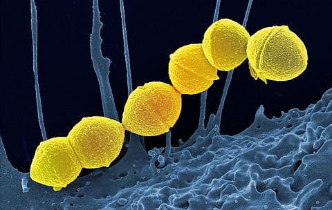 UK: Six children die of Strep A, a common bacterial infection