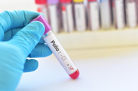 The increase in cases in 2022 shows the fragility of the fight against polio, said a recemnt commentary. Photo: iStock
