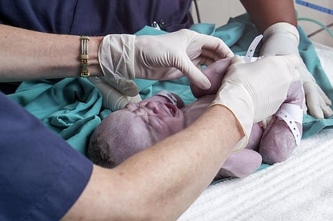 Neonatal mortality rate in Kenya shows no significant change in 8 years: Survey