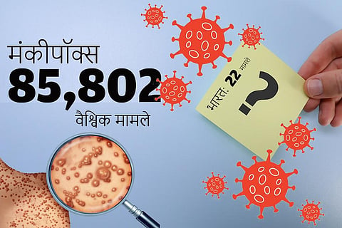 एमपॉक्स अपडेट: स्वीडन में मिल चुके हैं 260 संक्रमित, नीदरलैंड में भी 1260 पर पहुंचा आंकड़ा