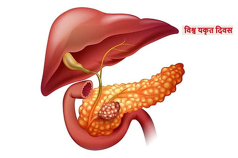 विश्व लिवर दिवस : क्या होता है फैटी लिवर, जानें अपने लिवर को स्वस्थ रखने के तरीके