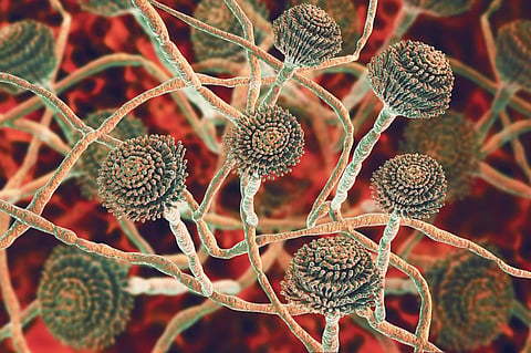 Fungal infections in the brain aren’t just the stuff of movies — Africa grapples with a deadly epidemic