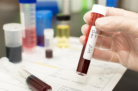 About 82,000 mpox cases were reported to the WHO during the multi-country outbreak. Around 32 000 cases had information on HIV status. Photo: iStock