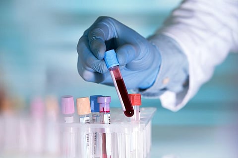 Alzheimer’s disease blood tests: Here’s what they look for and what they can tell you about your risk