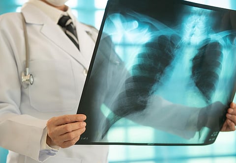 Photo for representation: iStock
