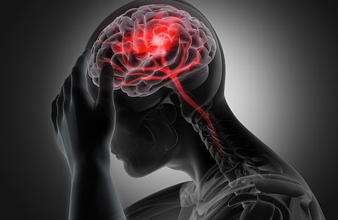 conceptual artwork of a man with brain stroke