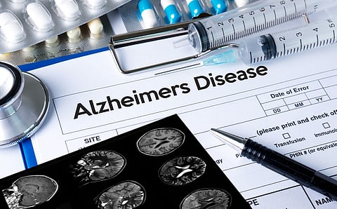 New study pinpoints potential target involved in stress response for treating Alzheimer’s disease