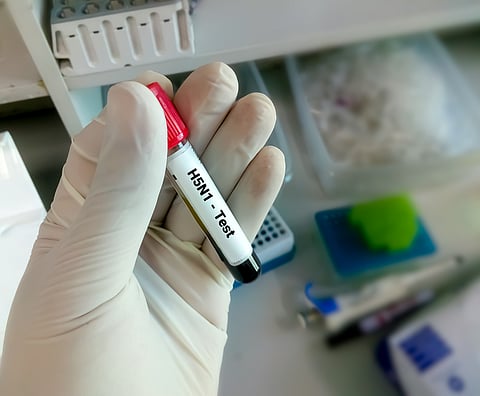 Researchers uncover critical mutations in H5N1 bird flu strain from infected Texan