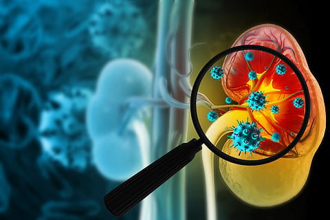 From popping painkillers to shortage of sleep, seven common habits that could be harming your kidneys