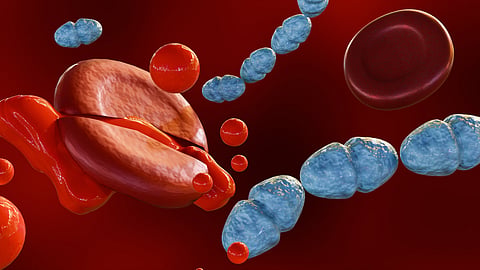 Post-sepsis syndrome: When the body recovers but the brain doesn’t