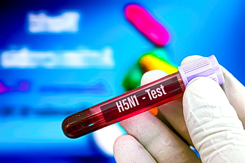 US reports first human bird flu case since February, source of infection undetermined so far