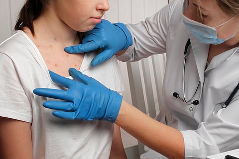 We study pandemics, and the resurgence of measles is a grim sign of what’s coming