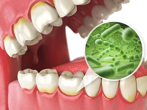 Ancient human teeth could also provide information on how the oral microbiome has evolved over the years. Photo for representation: iStock