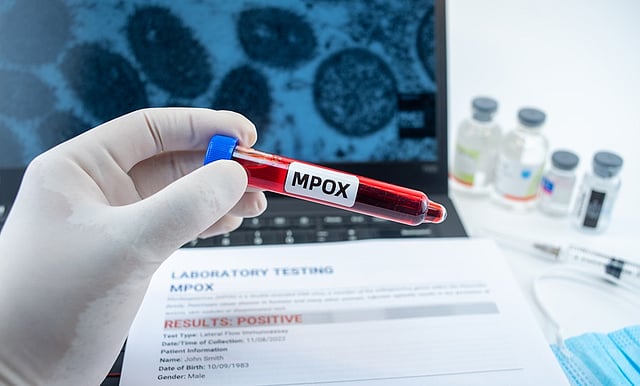 India Reports First Case of Deadly Clade 1b Mpox Strain in Kerala