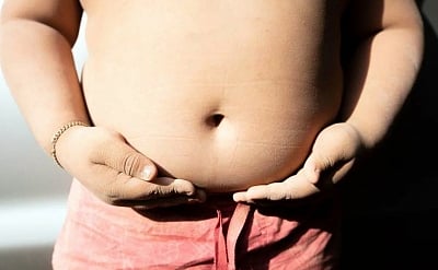 Most nations, including India, off track on childhood obesity goal