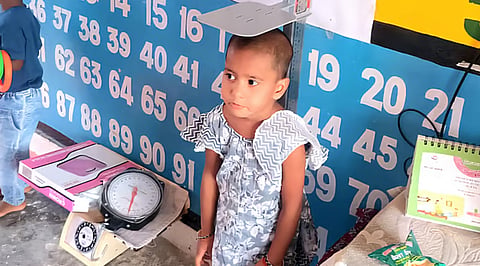 Malnutrition rampant in Uttarakhand, Almora hit worst