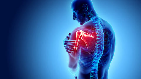 Could a past bone break lead to Arthritis in later life?