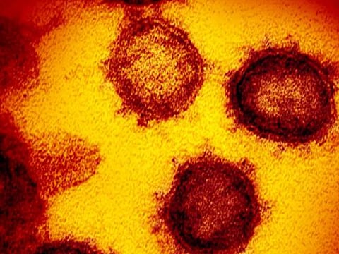  The shield before the arrow: Researchers unveil AI-driven 'Universal Vaccine' to pre-empt next pandemic