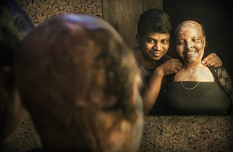 Rani may not look like the 17-year-old in the passport-size photograph anymore, but she isn't a scarred 25-year-old either