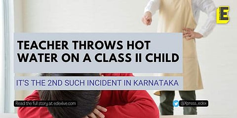 Teacher throws hot water on child in Karnataka | (Pic: Edexlive)
