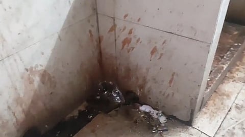 দেওয়ালে নোংরা দেখা যাচ্ছে 