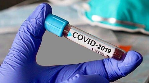 Covid-19