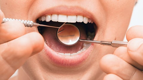 Rare Teeth Surgery  