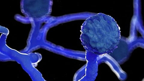 mucormycosis