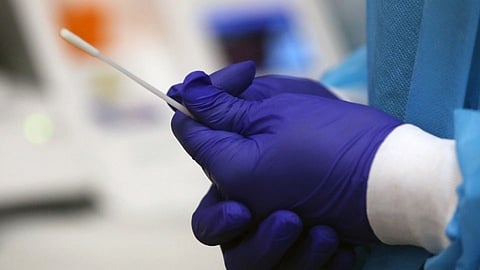 स्वॅब दिलेली व्यक्ती बाहेर दिसताच बसणार दंड