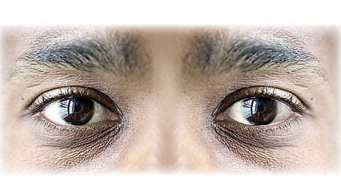 Eyes