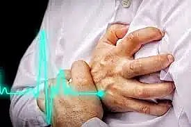 heart attack