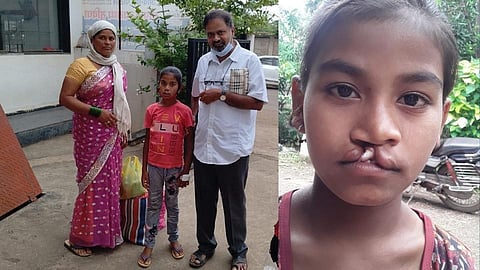 अन् 14 दिवसात तिच्या चेहऱ्यावर आली ‘मुस्कान’