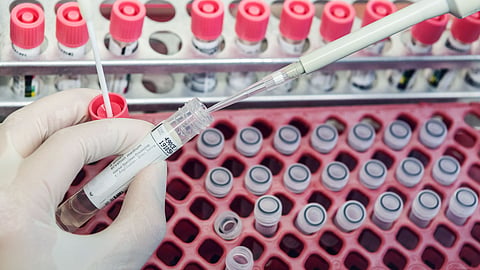vaccine testing