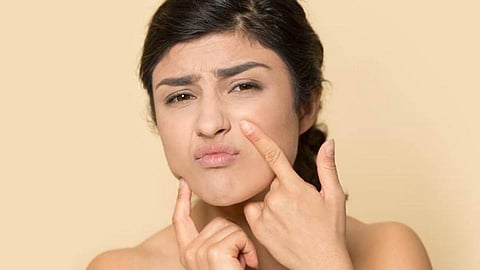 What causes dry skin