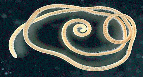 Centipedes