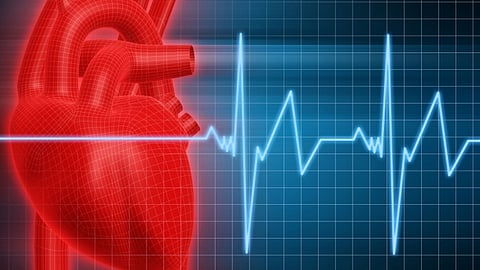 ECG