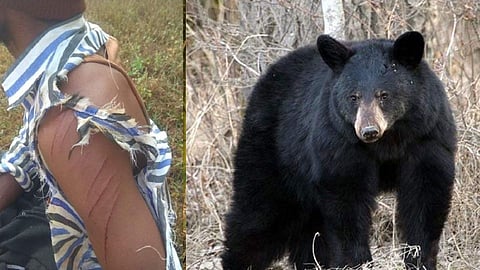  Bear Attack News in Kolhapur