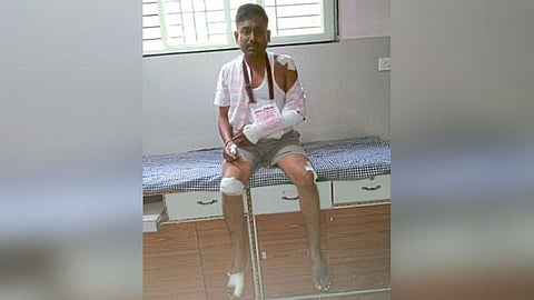 Nagpur sakal Journalist injured pig fight