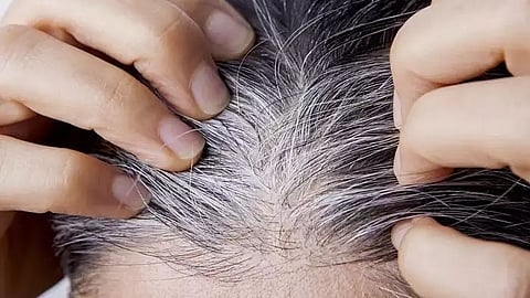 white hair