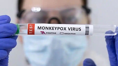 Monkeypox Latest News