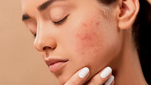  skin ailments