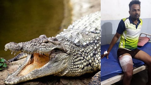 Crocodile bit the young man's leg