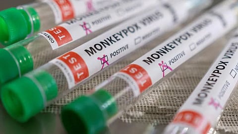 monkeypox 